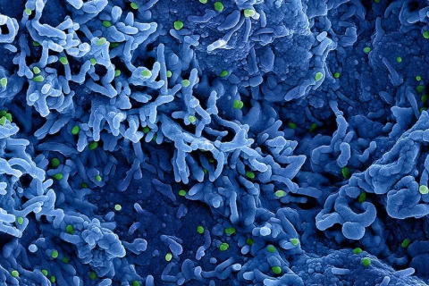 Saúde: “Mpox” Brasil registra 1,5 mil casos de mpox em