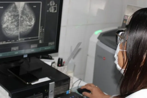 Feira de Santana: “Câncer de mama” Secretaria de Saúde diagnosticou 11 casos de câncer de mama este ano